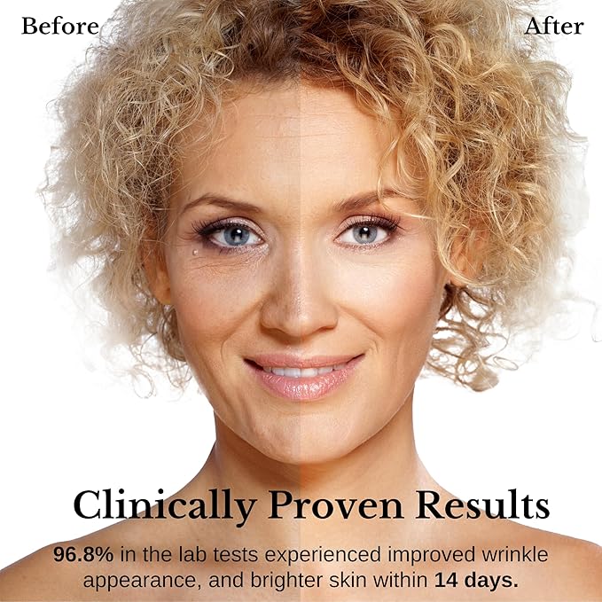 Wrinkle Serum Cream, Retinol & Bakuchiol & Niacinamide, 10 Vitamins & Herbs, Antioxidant, Eye Bag Dark Neck Correction, Day & Night Skin Brightening, 1.76 Fl Oz. Made in Korea
