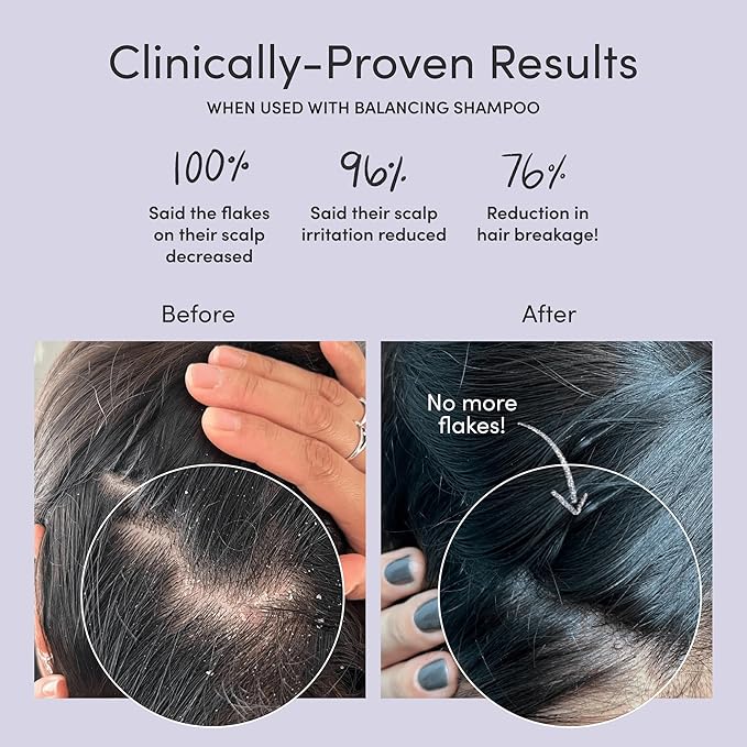 Jupiter Anti-Dandruff Shampoo and Serum, for Women & Men, Dermatologist-Formulated for Flaky, Itchy, Oily, & Dry Scalp, Sulfate-Free, Vegan, Color-Safe, & Paraben-Free, Shampoo with Zinc