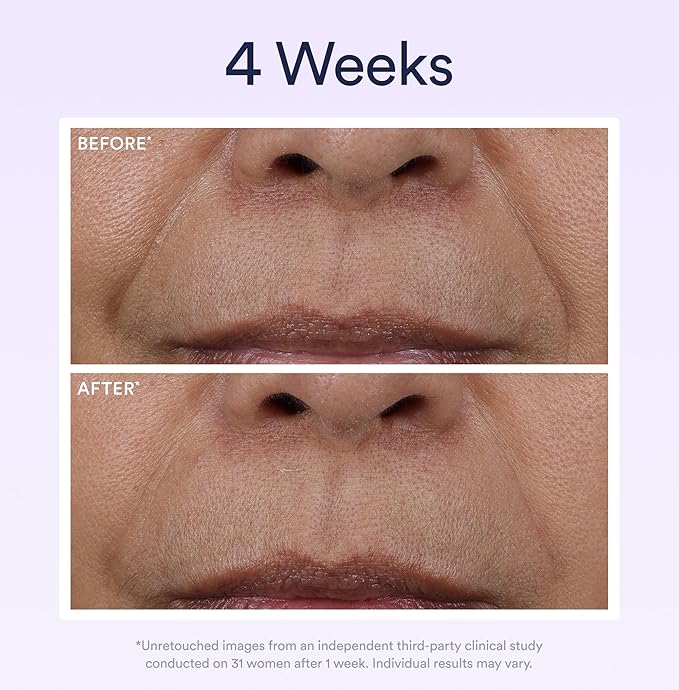 OSEA Dream Night Serum with Bio-Retinol - 1oz - Anti-Aging Night Serum for Face - Firming Peptides - Reduces Wrinkles, Firms & Brightens Skin