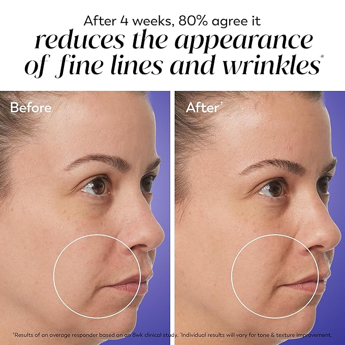 Olay Regenerist Retinol Face Moisturizer, Smooth & Renew Cream for Women, Fragrance-Free - Anti-Aging, Anti-Wrinkle, Fine Lines, Tightening, Brightening - Recyclable Eco Jar, Non-Greasy, 2 Oz