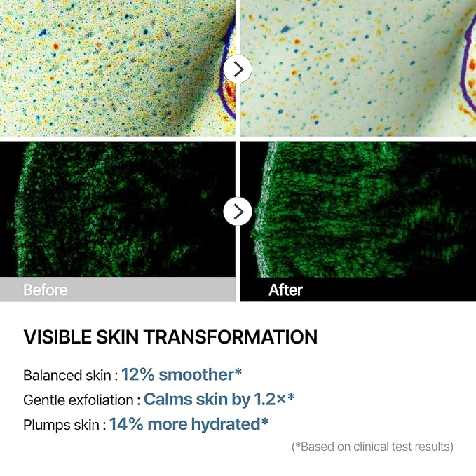 THOME G-Peel Program One Day Kit – Korean 4-Step Radiant Skincare Facial – Low Irritating & Gentle on Sensitive Skin – Brightens, Smooths & Strengthens Barrier (1 Sheet)