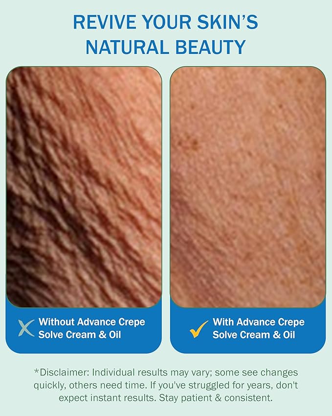 Advanced Firming Oil Crepe Skin (2 Pk, 4 Fl Oz each) - Made with Natural Oils, Licorice Root & Chamomile Extract - Moisturizing Crepey Skin Tightening and Firming Oil, Made in USA