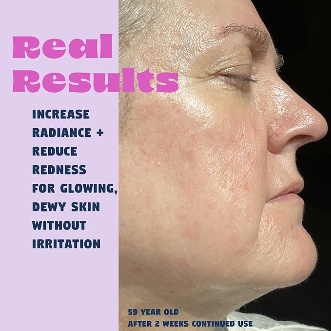 Star Light Snail Mucin Face Serum with Blue Light Skin Protection, 3.38 Oz – Silky Smooth Korean Glow Serum that Restores Moisture and Leaves Skin Brighter, Plumper, Soothed and Smooth