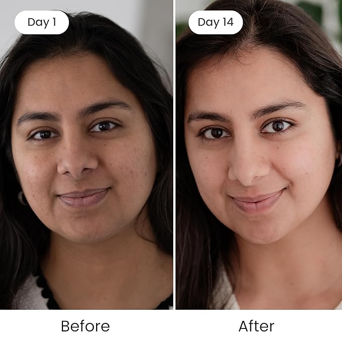 Shankara Kumkumadi Oil with Pure Saffron and Ayurvedic Herbs (Original Aroma 5ml)