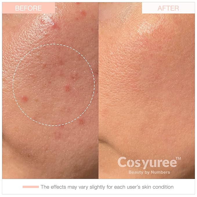 Collagen Deep Absorbing Hydrogel Mask, Korean Collagen Hydrogel Mask, Overnight Face Mask, Hydrating, Glass skin, Rejuvenation, Korean Skincare, 34g x 5ea