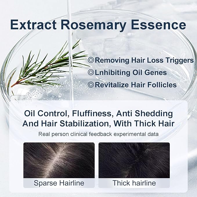 Tgideas Organic Biotin & Rosemary Hair Growth Shampoo – Thickening Shampoo with Amino Acids for Hair Loss, Dandruff Control & Oily Scalp - for Women & Men