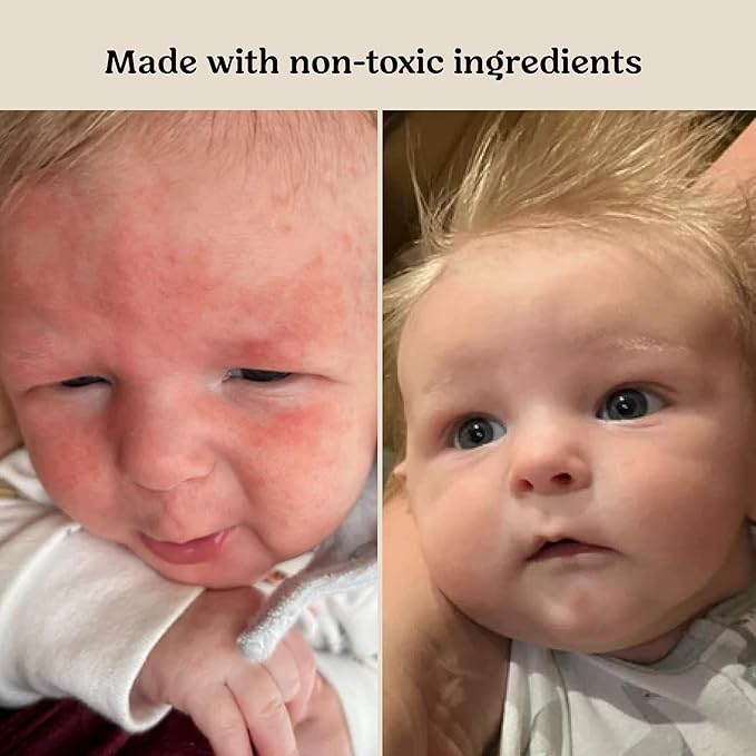Roe Wellness- Baby Cream Lotion Ointment EWG Verified Non-Toxic Ingredients | Full Body Biome Barrier | Dry Skin, Itch Relief, Moisturizing, All Over Ointment | Toddlers & Kids