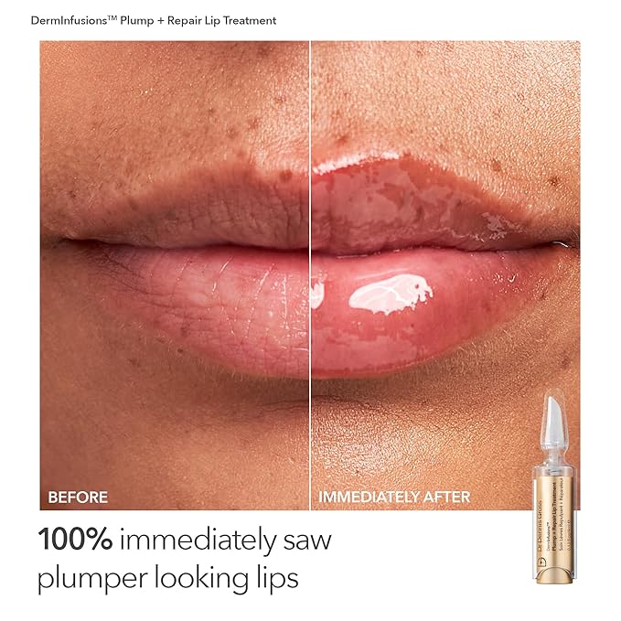 Dr. Dennis Gross Fill, Plump & Firm Kit – DermInfusions™ Hyaluronic Acid Serum, Eye Cream & Lip Treatment | Boost Hydration, Smooth Fine Lines & Enhance Volume | $125 Value Limited Edition Gift Set