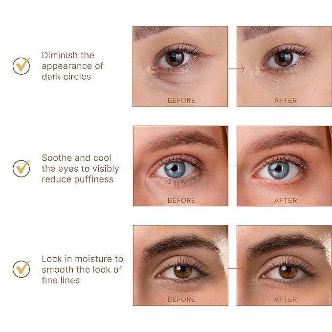 BRAWNA Hydrogel Undereye Mask Patch with Arbutin, Kojic Acid, Callogen, Peptides, Hyaluronic Acid - for Dark Circles, Puffy Eyes, Undereye Bags, Wrinkles - 24 Pairs - Rose