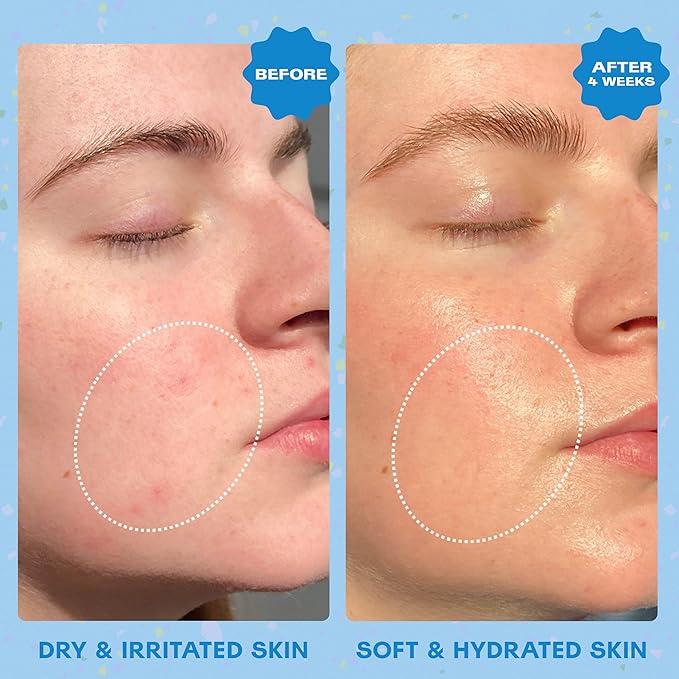 Squigs Bi-Phase Hyaluronic Acid Serum for Face - Ayurvedic Hydrating Face Serum with Niacinamide, Squalane & Turmeric for Moisturized, Glowing Skin - Vegan, Clean Beauty & Paraben Free - 1 FL OZ