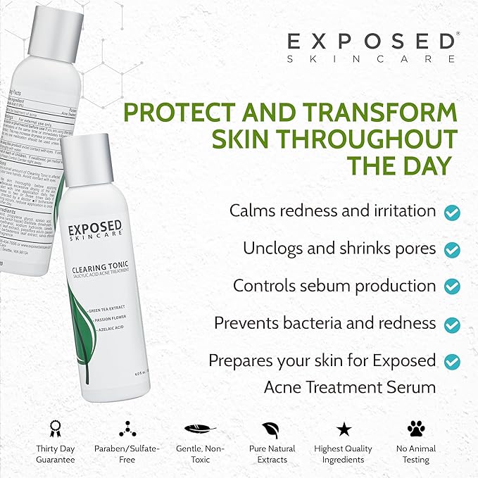 Exposed Skin Care, Clearing Tonic Facial Toner with 1% Salicylic Acid and Witch Hazel – Daily Toner for Teen and Adult Acne, Blackheads and Oily Skin – Natural, Non-Toxic and Cruelty Free
