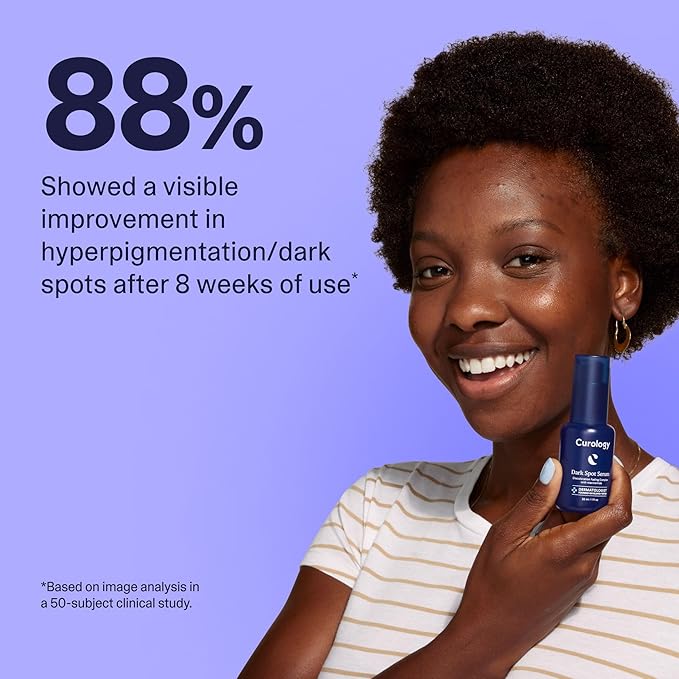 Curology Dark Spot Facial Serum, Discoloration Fading Serum, for Post Acne Marks and Sunspots, 1 fl oz