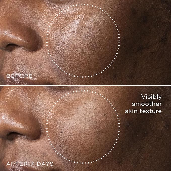 Medik8 C-Tetra Advanced - Balancing, Plumping, Hydrating Daily Vitamin C Serum with Hyaluronic Acid, Squalene - Smooths Fine Lines, Wrinkles - 1.0 oz