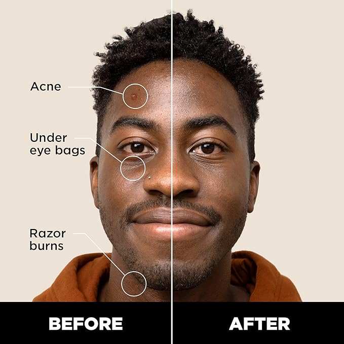 Stryx Concealer Stick Tool for Men, Deep Java - Natural Pigments Hides Imperfections, Acne, Razor Burns, Scars, & Rosacea - Highly Adaptable Shades for Easy, Undetectable Coverage - All Skin Tones