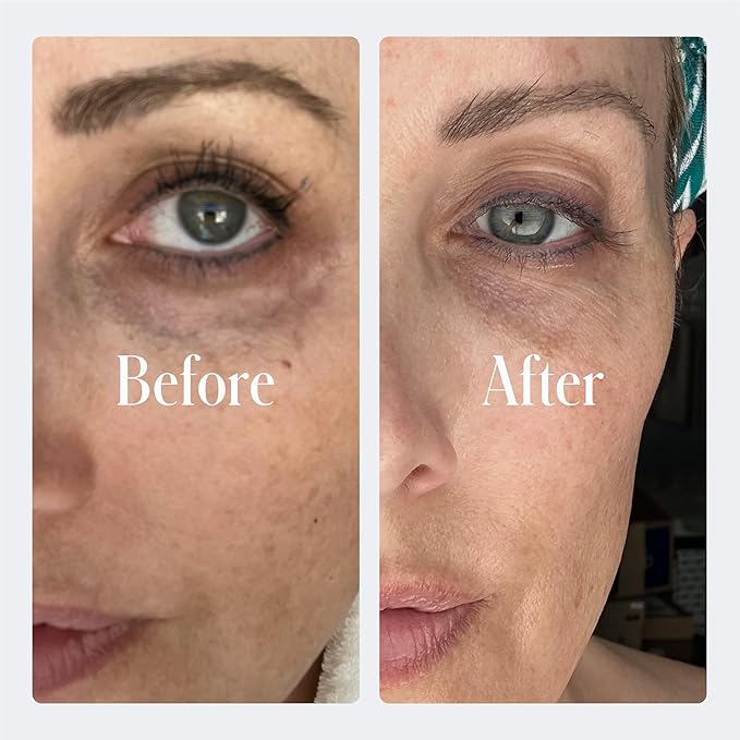 Geologie Dark Circle Under Eye Cream | Formulated to Help Dark Circles, Puffy Eyes Fine Lines & Wrinkles | Kojic Acid, Caffeine, Peptides, Niacinamide & Hyaluronic Acid