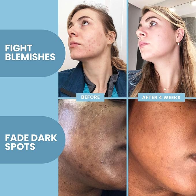 Eva Naturals Vitamin C Serum for Face – Anti Aging Dark Spot Remover with Retinol, Hyaluronic Acid, Niacinamide & Salicylic Acid – Face Serum for Women for Clear, Smooth, Radiant Skin