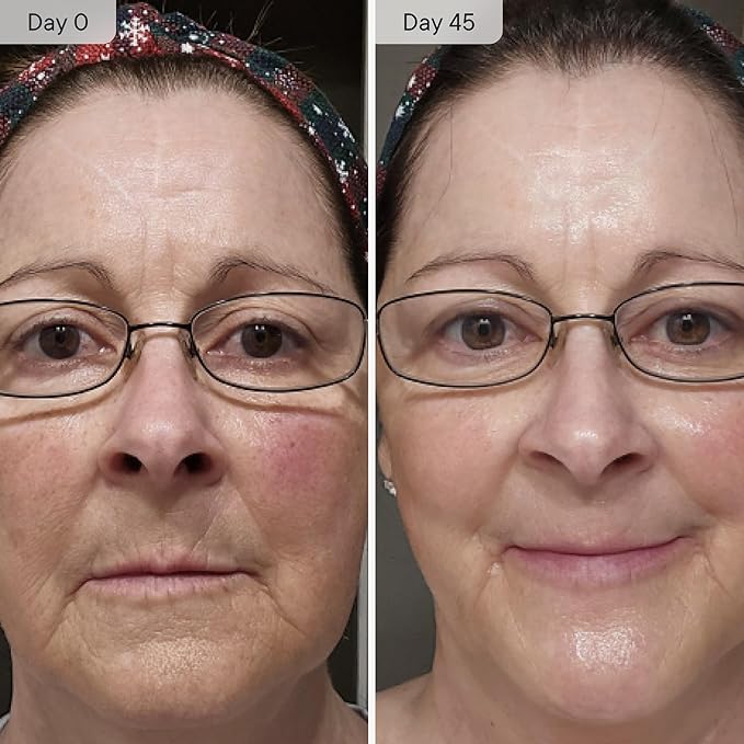 Qure Micro Infusion System for Face & Neck - Facial Moisturizing Essence, Even-looking tone, Serum for All Skin Types, Refreshed and Luminous Skin - 1-Month Supply