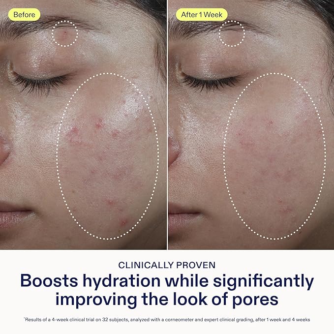 Skinfix Barrier Balancing Water Cream - 1.7 oz - Fast-Absorbing, Weightless Moisturizer for Combo + Oily Skin - Acne-Safe, Non-Pore-Clogging - Non-Comedogenic - Fragrance Free - Vegan, Cruelty Free