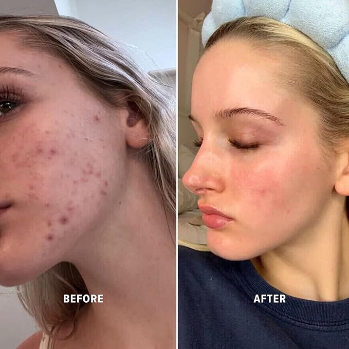 Glow Serum & Infinite Aura Moisturizer Bundle - THD Vitamin C Face Serum + Ceramide & Hyaluronic Barrier Repair Cream with Copper Peptide, 1 fl oz + 1.7 fl oz