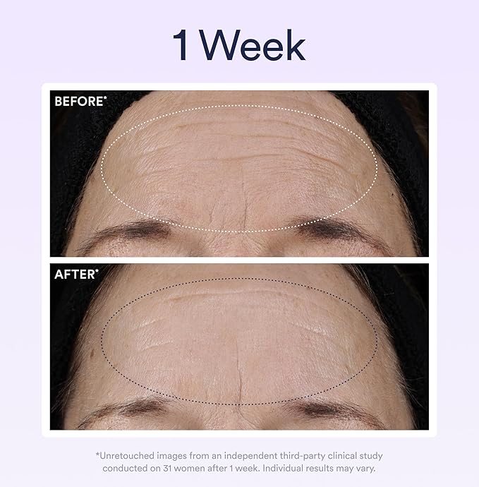 OSEA Dream Night Serum with Bio-Retinol - 1oz - Anti-Aging Night Serum for Face - Firming Peptides - Reduces Wrinkles, Firms & Brightens Skin