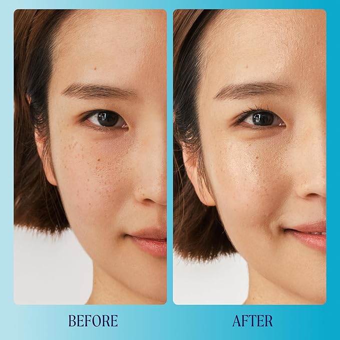 Kinship Supermello Hyaluronic Gel Cream Moisturizer – Nourish + Soothe Dry Sensitive Skin – Lightweight, Hydrating Face Lotion – Plump + Smooth – Reduce Redness – Daily Use Clean Skin Care (1.75 oz)