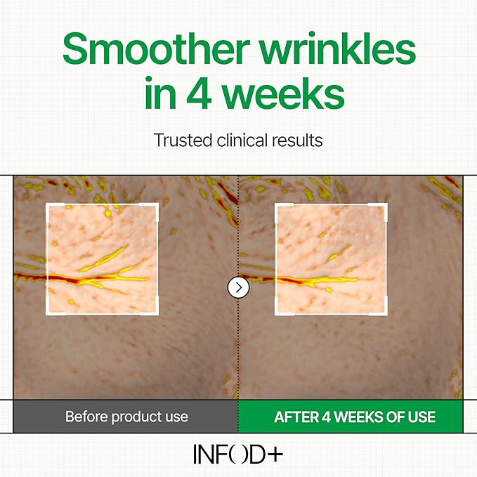 INFODPLUS Repair Cream 50ml – Exosome & Ceramide Complex | Barrier Repair, Hydrating, Anti-Aging Face Moisturizer for Sensitive Skin