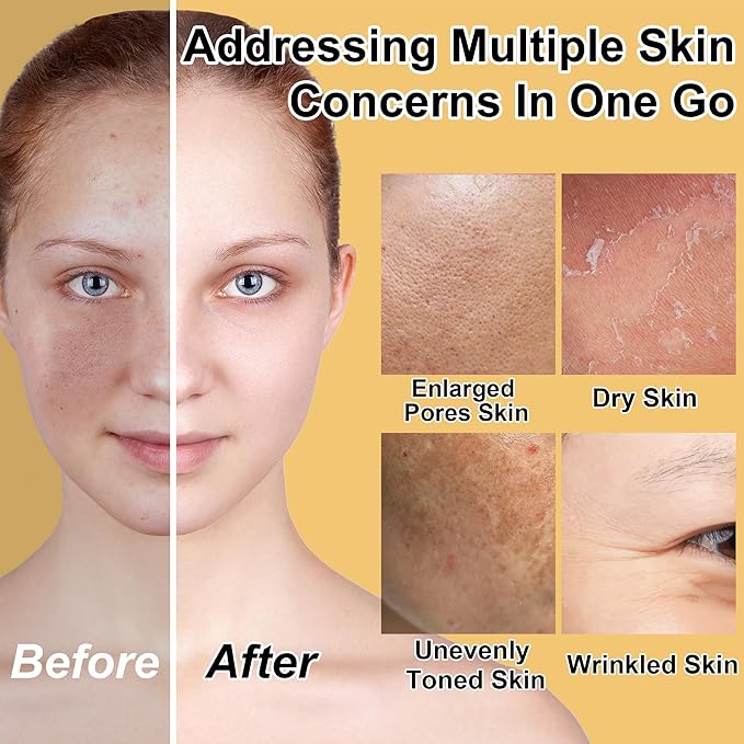 Skin Care Set for Women Teen 6 Pcs - Hydrating & Anti-Aging Facial Routine Skincare Products,Cleanser,Toner,Retinol Serum,Niacinamide Hyaluronic Acid Serum & Face Cream - Gifts Women Christmas