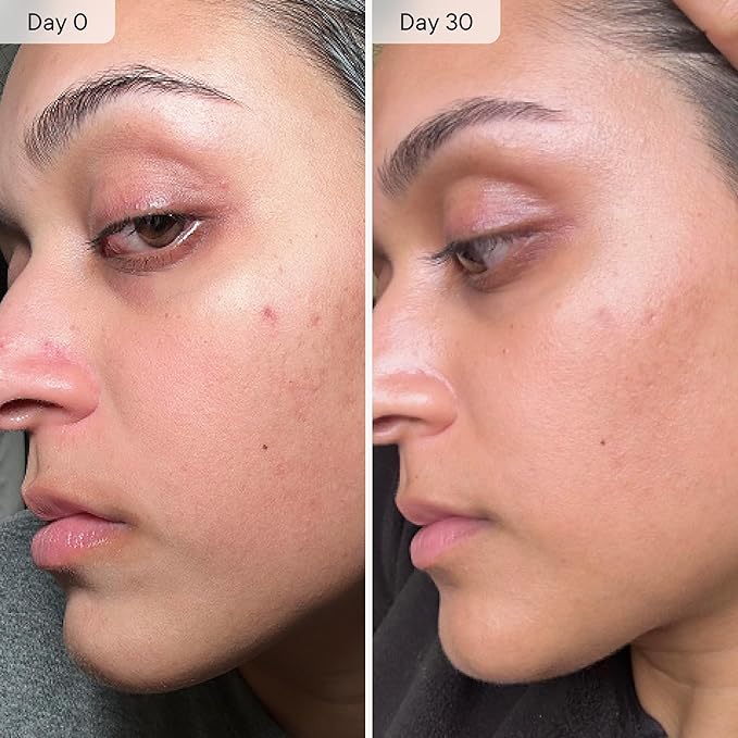 Qure Micro Infusion System for Face & Neck - Facial Moisturizing Essence, Even-looking tone, Serum for All Skin Types, Refreshed and Luminous Skin - 2-Month Supply