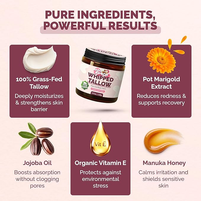 Whipped Beef Tallow for Skin – Grass-Fed Tallow Balm Moisturizer with Jojoba Oil, Manuka Honey & Calendula – For Face, Lips, Hands & Body – For Dry or Sensitive Skin.