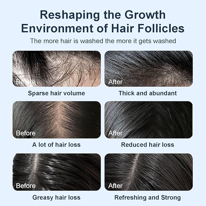 Tgideas Organic Biotin & Rosemary Hair Growth Shampoo – Thickening Shampoo with Amino Acids for Hair Loss, Dandruff Control & Oily Scalp - for Women & Men