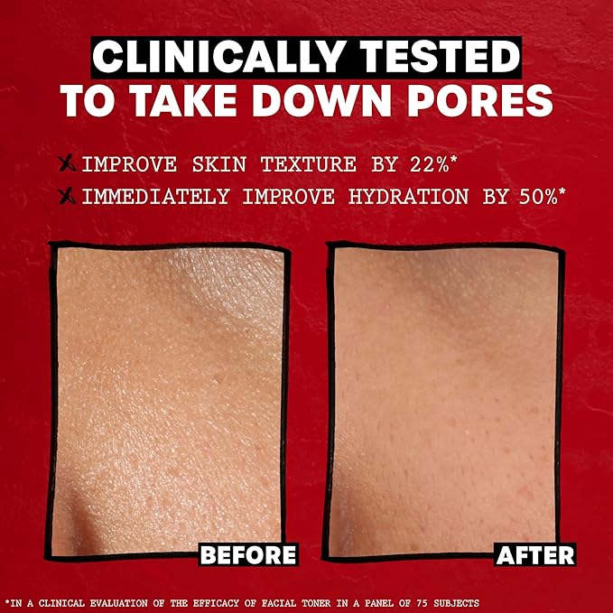 THAYERS Alcohol-Free, Hydrating Lavender Witch Hazel Facial Toner with Aloe Vera Formula, Vegan, Dermatologist Tested and Recommended, 12 Oz (Packaging May Vary)