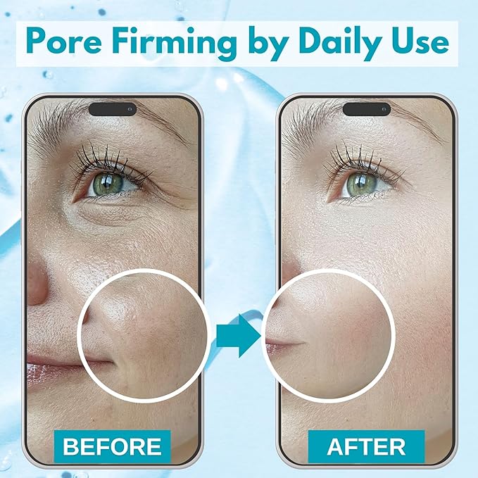 Lululun 28EA Hydrating Face Mask for Acne-Prone Skin & Sensitive Skin, Natural Face Mask for Women & Men with Azelaic Acid & Bifida Ferment, Daily Facial Mask Sheet & Sheet Mask from Japan, Hydra-AZ