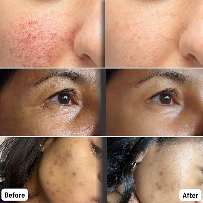 ORGAID Organic Sheet Mask | Made in USA (Anti-aging & Moisturizing, pack of 4)