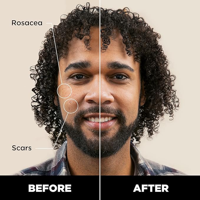 Stryx Concealer Stick Tool for Men, Dark Eclipse - Natural Pigments Hides Imperfections, Acne, Razor Burns, Scars, & Rosacea - Highly Adaptable Shades for Easy, Undetectable Coverage - All Skin Tones