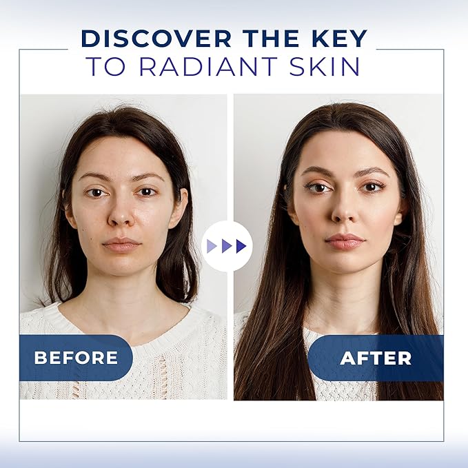 Micro Needling Serum for Face - Hyaluronic Acid Total Package Serum with Vitamin B5 - Acido Hialuronico for Sensitive Skin, Anti- Aging, Brightening, Uneven Skin Tone, Fine Lines & Wrinkles