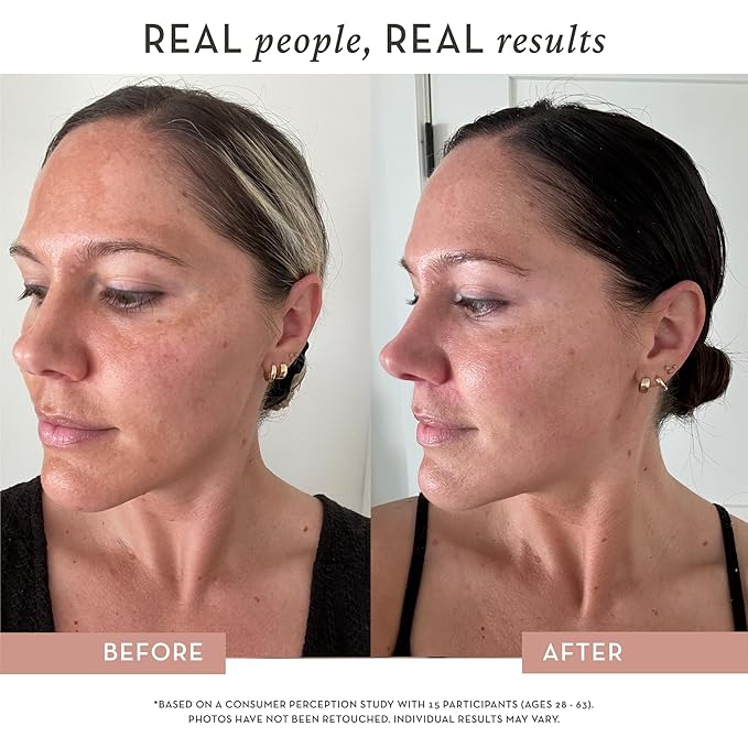 Dose of Glow Vitamin C Serum- Hydrating and Brightening Serum with Peptides, Hyaluronic Acid, Niacinamide and CoQ10. Firms Skin and Reduces Dark Spots and Fine Lines. 1 fl oz