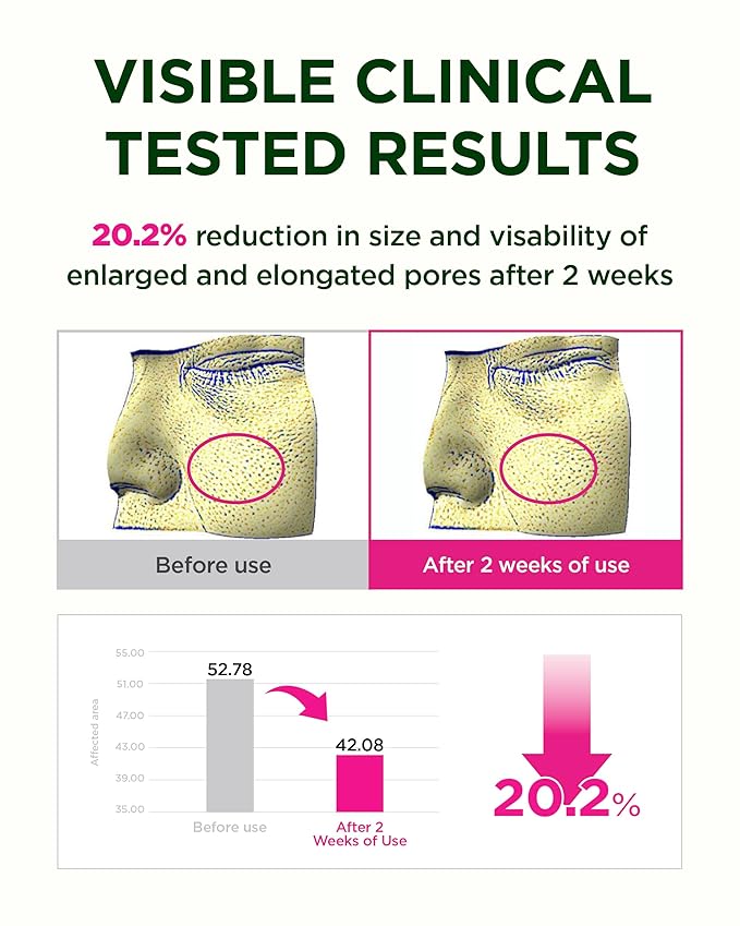 CKD Retino Collagen Boosting Hydrogel Face Mask (1ea) - Korean Overnight Jelly Mask for Glass Skin, Deep Moisturizing, and Pore Minimizing with Retinal & Low Molecular Collagen. Korean Skin Care