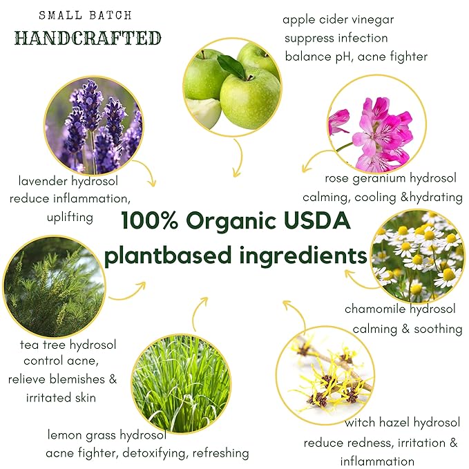 Apple Cider Vinegar Acne Face Wipes-Organic TeaTree, Rose, Chamomile, Witch Hazel.Oil free. Reduce Blemish & Acne. Tone,Restore, Sooth, Balance pH. Dry, Normal, Sensitive Skin. 25ct. USA Hello Cider