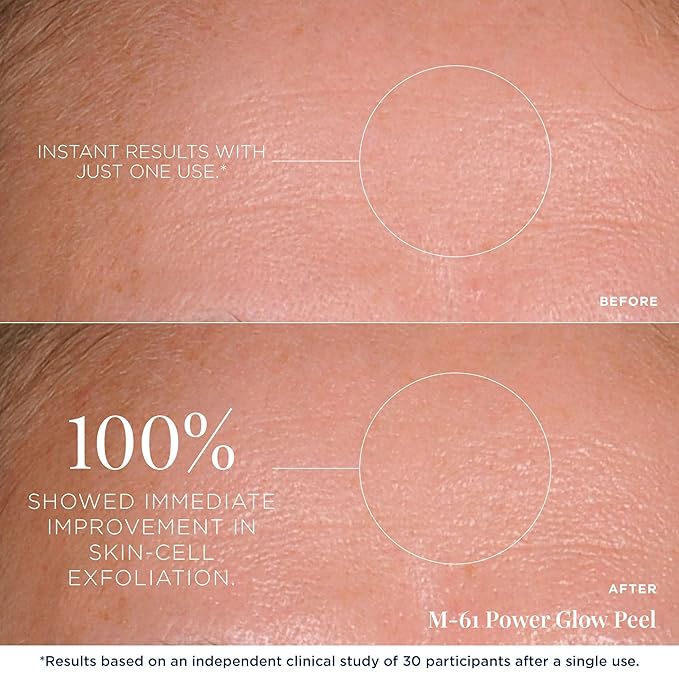 m-61 PowerGlow Peel | Exfoliating Facial Peel With Glycolic, Salicylic Acid. 1 Minute, 1 Step - 10 Treatments