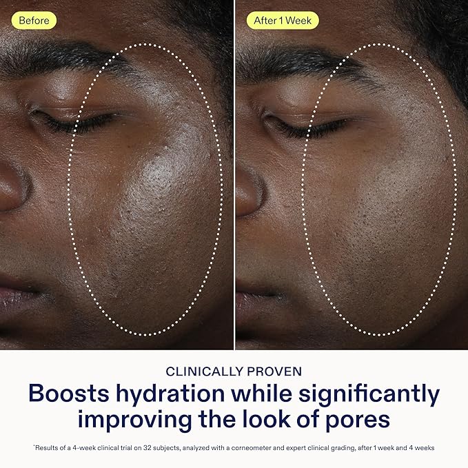 Skinfix Barrier Balancing Water Cream - 1.7 oz - Fast-Absorbing, Weightless Moisturizer for Combo + Oily Skin - Acne-Safe, Non-Pore-Clogging - Non-Comedogenic - Fragrance Free - Vegan, Cruelty Free