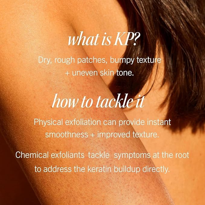 First Aid Beauty - KP Bump Eraser Body Scrub with 10% AHA, Keratosis Pilaris Exfoliator with Glycolic and Lactic acids, Helps Reduce Chicken Skin Bumps, Safe for Sensitive Skin, Strawberry Scent, 8 oz