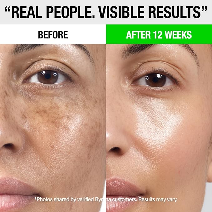 Dark Spot Clarity Oil Serum with Vitamin C for Uneven Tone & Post-Acne Marks – Korean Vegan Skincare with Ginseng Berry, Licorice Root, Arbutin & Tranexamic Acid by BYRANA – 1 oz