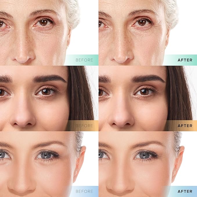 Cosmedica Skincare Facial Serum Trio Set Value for Clear Skin - Vitamin C Super Serum, 2.5% Retinol Serum, Pure Hyaluronic Acid Serum – Vegan, Cruelty-Free Skincare 6 pack