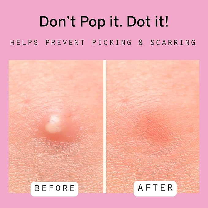 Dot Pimple Zit Patches for Face – Dermatologist Recommended & Ranked 1 for Most Effective Blemish Support – All Natural Hydrocolloid Acne Stickers with Vitamin C & Salicylic Acid (8 & 12 mm, 108 ct)