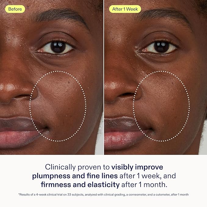 Skinfix Triple Lipid Activating Serum - 1 oz - Visibly Smooths & Firms Skin - Reduces Fine Lines & Wrinkles - Fast Absorbing, Non-Comedogenic, Fragrance Free, Vegan, Cruelty Free