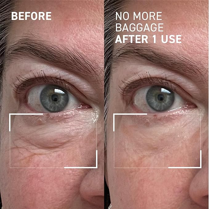 Dr. Brandt Needles No More, No More Baggage - 0.5 oz, Pack of 2 - Minimizes Under-Eye Bags, Puffiness & Dark Circles