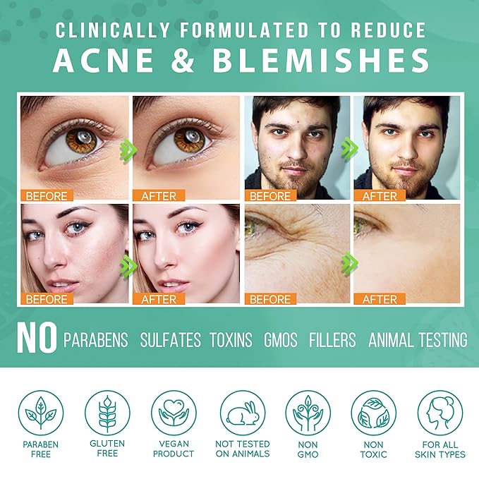 LILY SADO TEA+C™ Green Tea & Vitamin C Face Cleanser – Natural Vegan Antioxidant Daily Face Wash with Aloe, Rosehip, Meadowfoam - Gentle Deep Cleansing for Acne, Blackheads, Blemishes. 8 oz