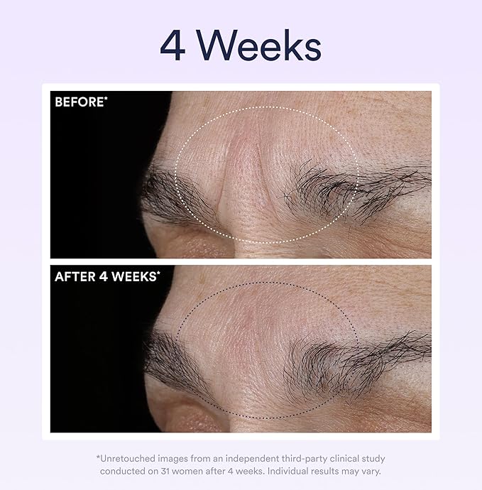 OSEA Dream Night Serum with Bio-Retinol - 1oz - Anti-Aging Night Serum for Face - Firming Peptides - Reduces Wrinkles, Firms & Brightens Skin