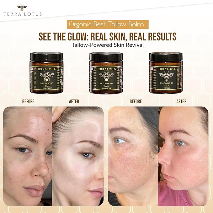 Organic Grass-Fed Beef Tallow Balm with Raw Honey - Moisturizing Cream for Soft, Smooth Skin - Handmade All-Natural Moisturizer (4oz, Unscented)