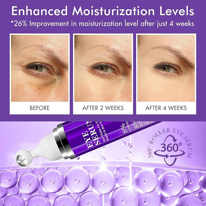 Under Eye Roller Serum - 8% Caffeine & 8% Retinol Eye Cream for Dark Circles, Puffiness and Bags, Puffy Bags Fine Lines Wrinkles, 360° Massage Ball Cream, Hyaluronic Acid Serum for Men & Women
